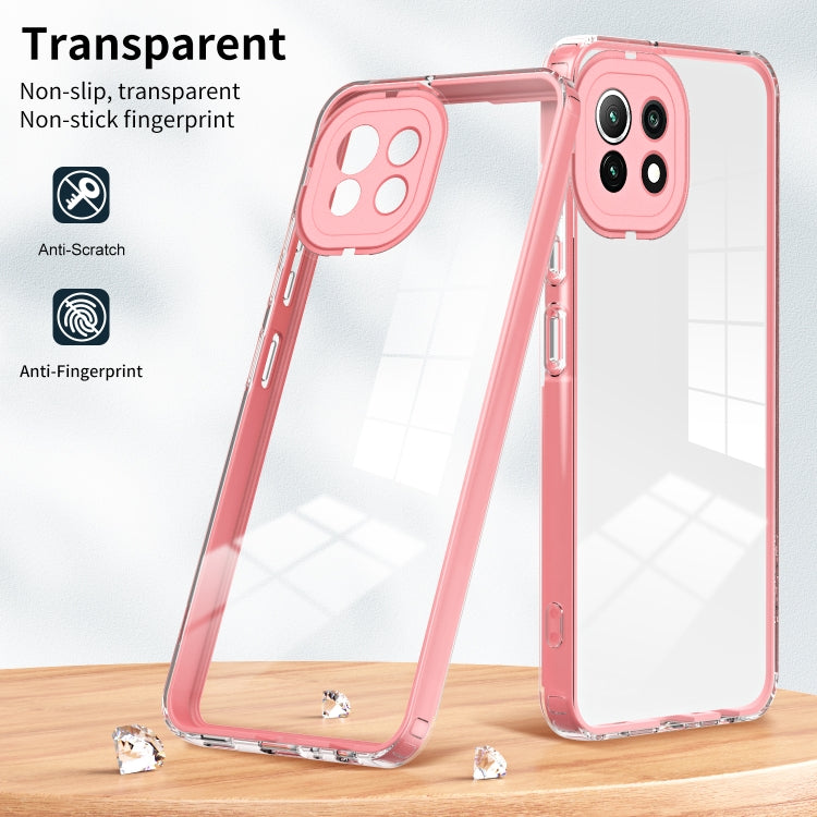 FRAME Zadný kryt pre Xiaomi Mi 11 Lite / Mi 11 Lite 5G - ružový