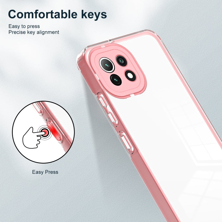 FRAME Zadný kryt pre Xiaomi Mi 11 Lite / Mi 11 Lite 5G - ružový